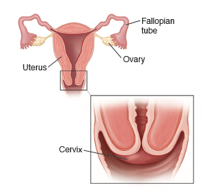 Vista frontal del corte transversal de un útero con las trompas de Falopio y los ovarios. El recuadro muestra un corte transversal en primer plano del cuello uterino.