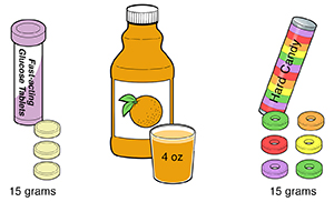 Des exemples de 15 grammes de glucides, montrant des comprimés de glucose, du jus de fruits, et des bonbons durs.